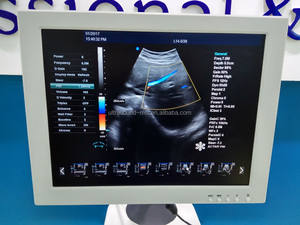 Mesin USG Medis 4D Harga Terjangkau, Mesin USG Diagnostik Doppler Warna dengan Troli, Medsinglong MSLTU04 untuk Rumah Sakit - Product Image 2