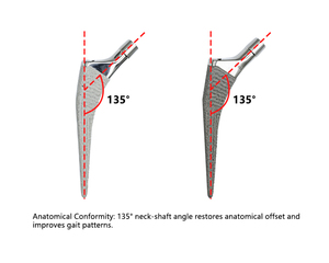 Sistema de Reemplazo <span class=keywords><strong>Total</strong></span> de Cadera Anatómico Profesional de Grado Médico Sin Cemento, Implantes Quirúrgicos de Titanio con Recubrimiento de HA para Fracturas - Product Image 5