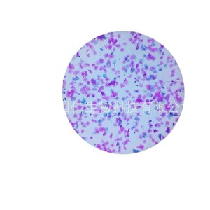 Portaobjetos de microscopio de adhesión Yi Guoren 76x26mm QP01 para patología con revestimiento de carga positiva - Product Image 5