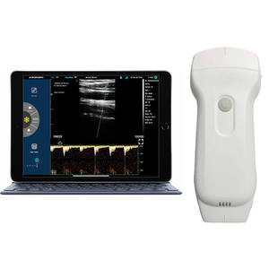 Suproductor Scanner Wireless a ultrasuoni MSLPU68 Plus con cavo tipo C trasduttore colore Doppler - Product Image 1