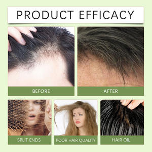 สบู่ทำความสะอาดเส้นผม 60 กรัม บำรุงหนังศีรษะ ซ่อมแซมเส้นผมแห้งเสีย ใช้ได้ทุกวัน - Product Image 4