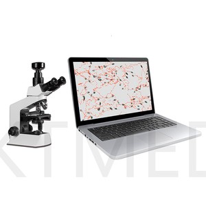 Analizador de Semen KTMED, Máquina Automática de Análisis de Esperma Portátil, Microscopio de Esperma Bovino, Analizador de Semen Canino Veterinario - Product Image 6
