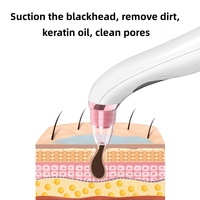 Dispositif en plastique d'instrument de beauté portatif pour le nettoyage du corps aspiration chaude et froide pour l'élimination des points noirs et de l'acné