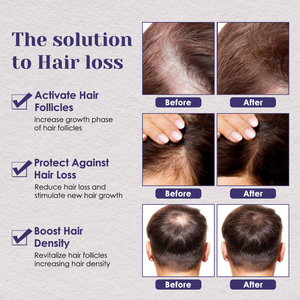 Siero per <span class=keywords><strong>la</strong></span> Crescita <span class=keywords><strong>dei</strong></span> <span class=keywords><strong>Capelli</strong></span> con Peptidi di Rame, Etichetta Privata, Previene Efficacemente <span class=keywords><strong>la</strong></span> <span class=keywords><strong>Caduta</strong></span> <span class=keywords><strong>dei</strong></span> <span class=keywords><strong>Capelli</strong></span> e Nutre, Promuovendo <span class=keywords><strong>la</strong></span> Crescita - Product Image 6