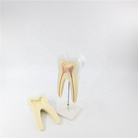 Dentier automatique de dents molaires, modèle médical