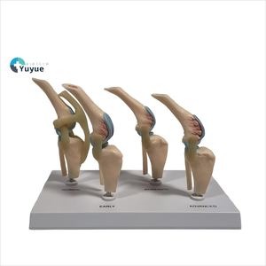 Modelo Comparativo de Articulación de <span class=keywords><strong>Rodilla</strong></span> Canina de Cuatro Etapas, Modelo de Demostración de Lesiones Articulares Normales, Tempranas, Moderadas y Avanzadas - Product Image 1