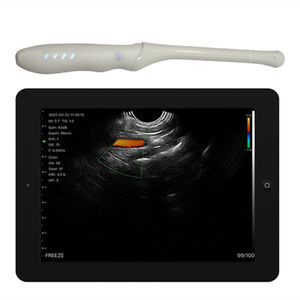 Sonde ultrasonique portative 4T Transvaginal Array Endocavity Doppler couleur sans fil - Product Image 1