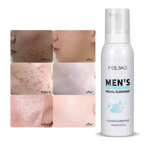 Aminoácido Espuma Acné Lavado DE CARA Natural Orgánico Limpiador facial diario Limpiador de ácido salicílico Limpiador facial para hombres