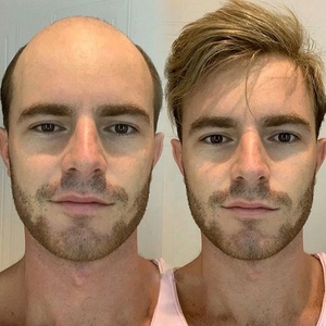 Extensiones de cabello humano para <span class=keywords><strong>hombre</strong></span>, tupé de seda con Base de seda, en oferta de <span class=keywords><strong>AMAZON</strong></span> - Product Image 1