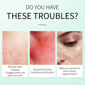 <span class=keywords><strong>Eau</strong></span> <span class=keywords><strong>micellaire</strong></span> nettoyante douce minérale Lanthome, démaquillant liquide pour le visage et les yeux, tous types de <span class=keywords><strong>peau</strong></span>, marque privée - Product Image 2