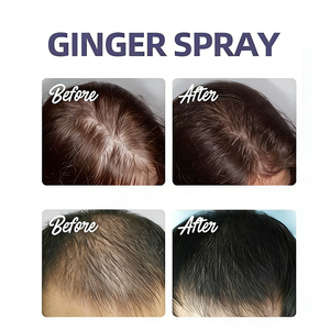 Green Ginger Anti-Hair Prevent Loss Oil,Ginger 7 Days Hair Growth Nourishing Regrowth <b>Spray</b>,King of Ginger Spraying - Product Image 6