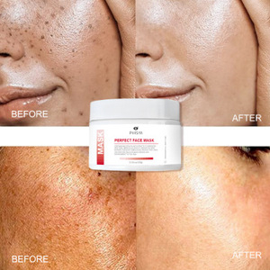 Masque de boue blanche de nettoyage des taches transfrontalières crème pour le <span class=keywords><strong>visage</strong></span> à pores profonds pour éliminer les points noirs acné et contrôle de l'huile Film de boue - Product Image 1