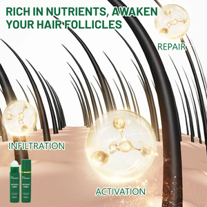 Oem Ginseng & hint yağı saç büyüme besin Roll-On folikül aktivatör saç baş masaj aleti yağ Serum siyah saç büyüme ürünü - Product Image 4