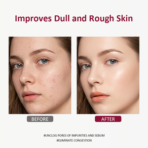 <span class=keywords><strong>Exfoliante</strong></span> facial abrillantador orgánico con pulpa de <span class=keywords><strong>Acai</strong></span> crema <span class=keywords><strong>exfoliante</strong></span> suave que aprieta los poros controla el brillo del aceite unifica el tono de la piel - Product Image 5