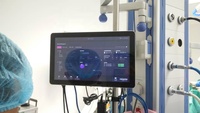 Monitor Layar Sentuh Kapasitif Touchwo 7 8 10.1 11.6 Inci 1024x600 10 Titik Sentuh VGA HDMI USB VESA Wall Mount Layar Industri