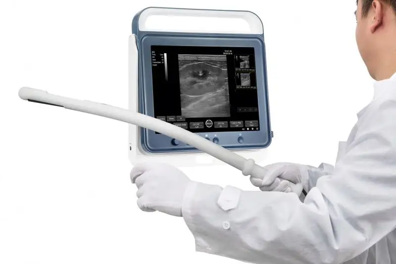 Draagbare Ultrasound Machine Medische Usg Pw Cw Dicom Cardiale Sonde Cardiologie Voor Ziekenhuis Kliniek