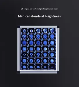 <span class=keywords><strong>Negatoscope</strong></span> de haute qualité pour scanner médical professionnel, visualiseur de films radiologiques, alimentation électrique, en métal et plastique durables - Product Image 2