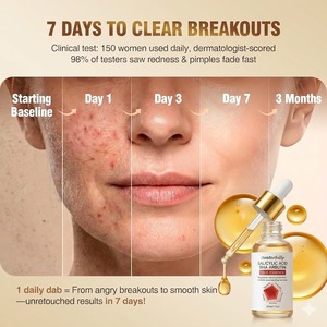 Sérum à l'<span class=keywords><strong>acide</strong></span> <span class=keywords><strong>salicylique</strong></span> à 2 % pour le visage, sérum exfoliant doux pour le visage contre l'acné, les points noirs et les pores dilatés, et réduit l'excès de sébum - Product Image 5