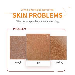 Vente en gros de lotion corporelle éclaircissante pour la peau, hydratante, blanchissante, à la vitamine C, naturelle, de marque privée, fabriquée en Thaïlande - Product Image 2