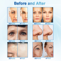 2024 pro microdermabrasion faciale hydro beauté eau aqua peeling hydra dermabrasion machine avec analyse de la peau