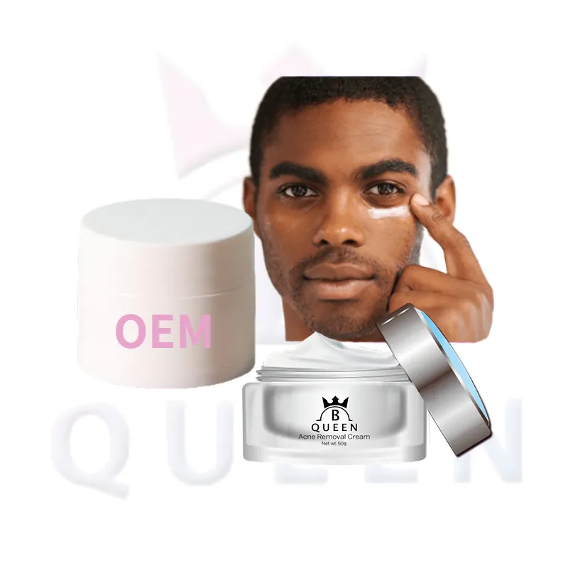 Wholesale Acne Face Cream Men Skin Care Anti Acne Natural Efficacious