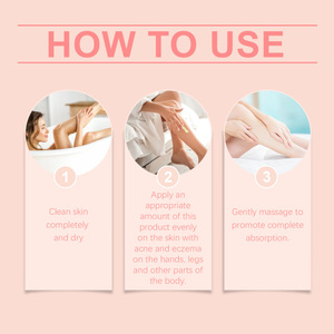 <span class=keywords><strong>Crema</strong></span> idratante per l'acne sleep sego idratante per la cura idrata e nutre l'elasticità della <span class=keywords><strong>pelle</strong></span> - Product Image 5