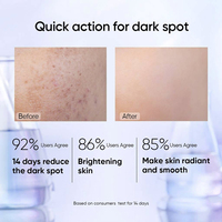 Sérum Visage Anti-Taches à la Niacinamide 377 – Produits de Soin de la Peau Marque Blanche – Essence Faciale Éclaircissante et Lissante pour Femmes