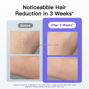 Depiladora indolora de enfriamiento de hielo de mano para afeitado permanente y depilación en el hogar - Product Image 5