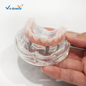 Modèle de Restauration d'Implant Maxillaire M6001-1, Structure de Prothèse Dentaire Démontable, Aide Pédagogique pour la Formation Dentaire - Product Image 4