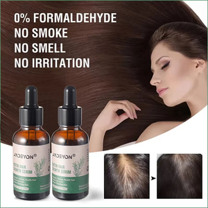 Personnalisé 100% Naturel Organique Marque Privée Essentiel Rapide Cheveux Sauvage Croissance Sérum Romarin Menthe Huile pour Femmes Noires Hommes - Product Image 3