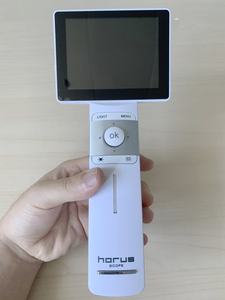 Otoscopio Digital EOC 700 Miis Horus Scope, Otoscopio Digital con Video - Product Image 2