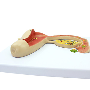 Modelo de Enseñanza del Proceso de Desarrollo del Útero y los Óvulos Humanos, Modelo de Órganos Reproductores Femeninos, Modelo Uteroinfalónico - Product Image 3