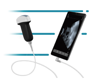 Draagbare Mini Usb Echografie Veterinaire Dierenarts Rectale Lineaire Usb Sonde Veterinaire Echografie Voor Dierlijk Gebruik - Product Image 1