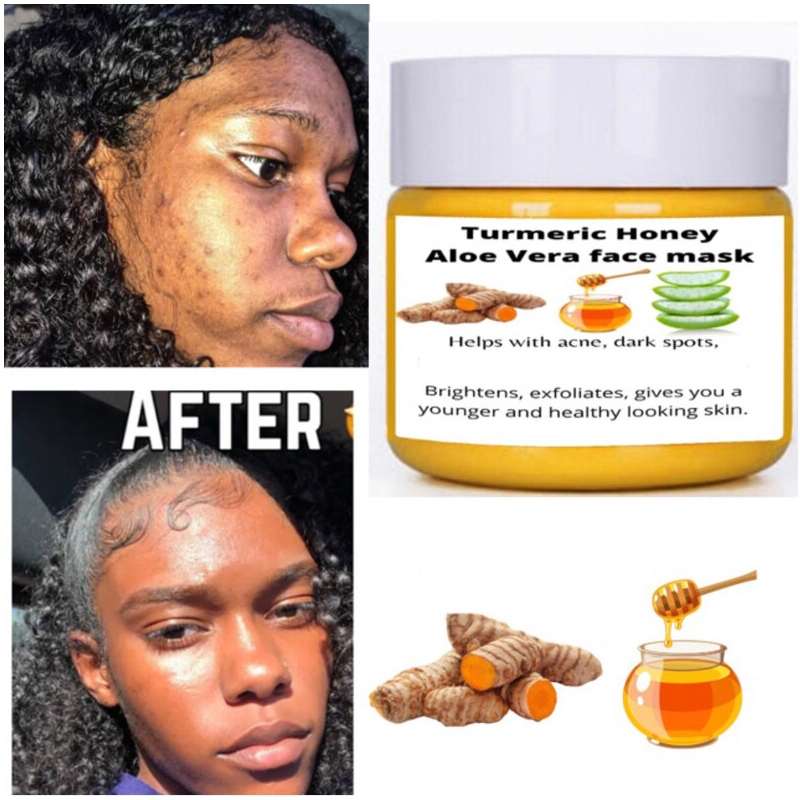 Turmeric Honey Aloe Vera Face Masks - Brighten & Nourish