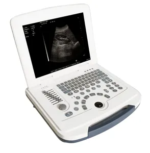 High Performance Laptop Full Digital Black and White Ultrasound Scanner for Mediacl Use