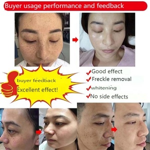 コラーゲンフェイシャルクリーム、肝斑を明るくし、アンチエイジング、色素沈着除去クリーム、ダークスポットリムーバー、美白クリーム - Product Image 3