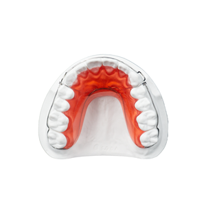 Retenedor Dental Ortodóntico Removible de Acrílico Clase II Hawley con Arco Labial y Cierre Personalizable Hecho en China - Product Image 6