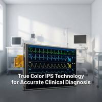 شاشة عرض طبية عالية الدقة مقاس 21.45 بوصة بتقنية FHD IPS LCD، شاشة مراقبة للمرضى في المستشفيات بدقة 1920×1080، نحيفة للغاية بسمك 8.9 مم، شاشة LED طبية عالية الجودة