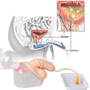 Modèle de formation au cathétérisme masculin avec système de vessie simulé pour la pratique des compétences infirmières - Product Image 2