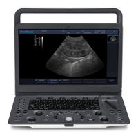 Système d'échographie vétérinaire noir et blanc SonoScape E1V portable avec écran de 15,6 pouces pour chiens, chats, bétail et animaux d'élevage