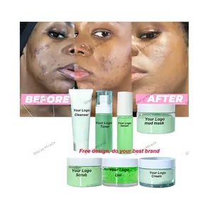 ชุดผลิตภัณฑ์ดูแลผิวหน้า OEM แบรนด์ส่วนตัว ฟื้นฟูผิวให้กระจ่างใส สุขภาพดี ควบคุมความมัน กระชับรูขุมขน ลดสิว <span class=keywords><strong>รีวิว</strong></span>ดี - Product Image 1