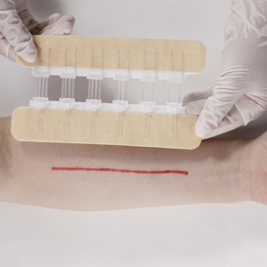 Dispositif de fermeture de plaie à fermeture éclair médicale pour les urgences - Product Image 3