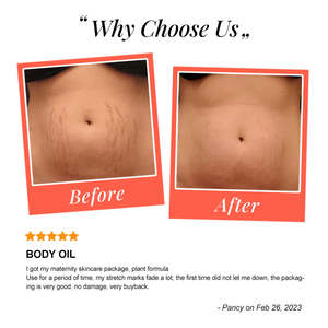 Aceite de masaje corporal orgánico con extracto de planta natural OEM, reparación de cicatrices, eliminación de estrías, aceite de maternidad para el cuidado de la piel con aceite de Baobab - Product Image 4