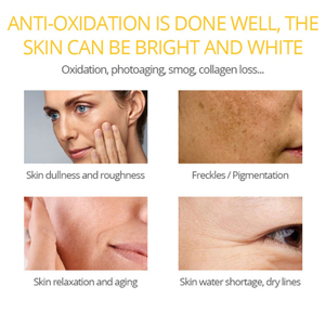 Actory itititititamin ACE erum Kin kin are nnti GE ACE hitace hitening rirefresca <span class=keywords><strong>la</strong></span> piel uidado e IEL it CID yaluronic CID erum - Product Image 5