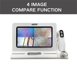 Analizador de Cuero Cabelludo Portátil Meicet, Inalámbrico, con WiFi, Luz LED, Detector de Folículos para Análisis Capilar, con IA Disponible, UE - Product Image 2