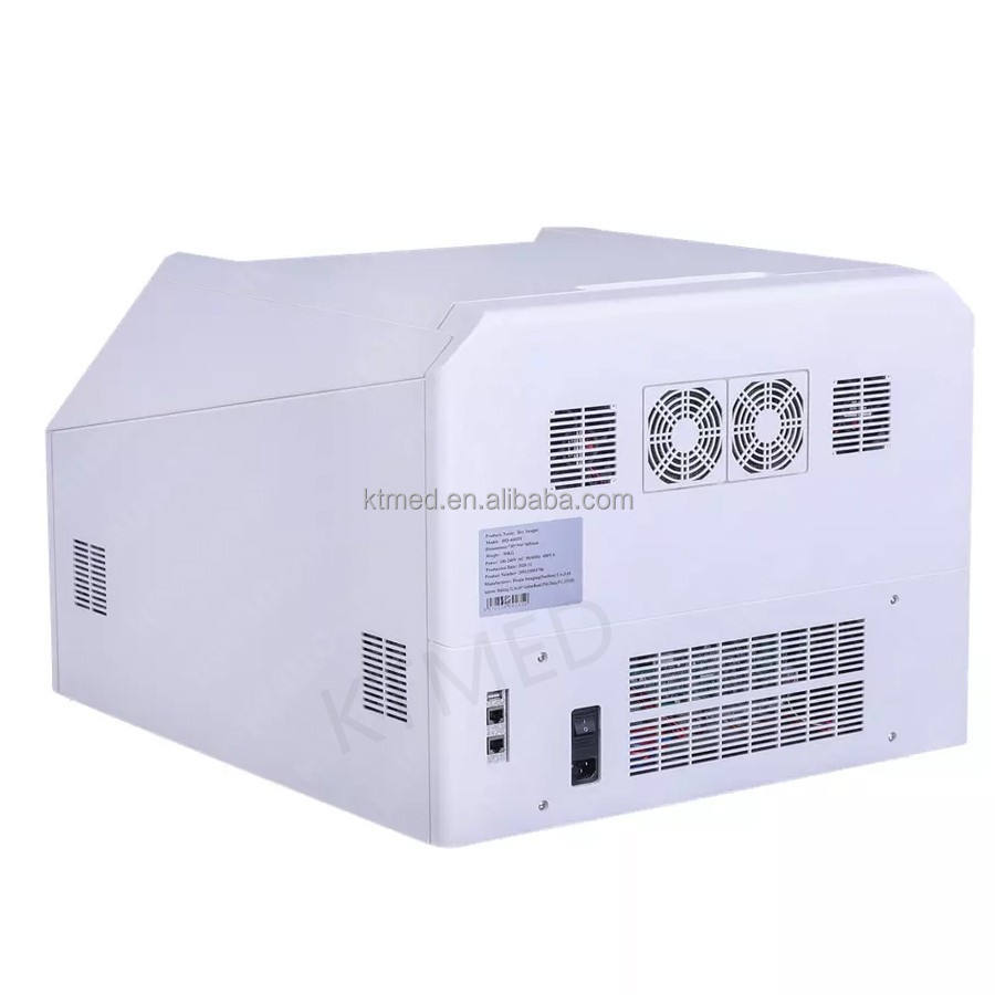 ORANGLES KT-D048 VETERINARY Digital X Ray Dry Thermal Image CT CR DR MRI Scanner Dicom System Medical X Ray Imaging Dry Thermal Printer - full product showcase - displaying specifications - Image 5 of 6 | adapts to any space | KT-D048 VETERINARY Digital X Ray Dry Thermal Image CT CR DR MRI Scanner Dicom System Medical X Ray Imaging Dry Thermal Printer deal New Jersey | Free Shipping ORANGLES