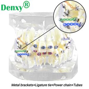 Modello dentale Denxy con staffa metallica legatura legatura catena elastica orto Typodont dentale per trattamento di dimostrazione ortodontica - Product Image 2