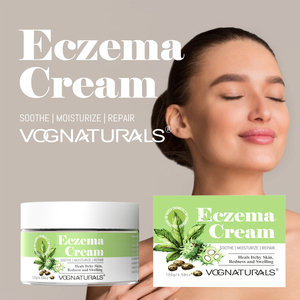 Crema Herbal <span class=keywords><strong>para</strong></span> Eczema de Marca Privada, Hidratante, Nutritiva <span class=keywords><strong>para</strong></span> la Piel, Tratamiento <span class=keywords><strong>para</strong></span> <span class=keywords><strong>Dermatitis</strong></span> y Psoriasis, Sin Esteroides, Calmante y Anti-Picazón - Product Image 3