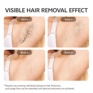 <span class=keywords><strong>Appareil</strong></span> d'<span class=keywords><strong>épilation</strong></span> au laser IPL Mlay Mini, utilisation à domicile sur tout le corps, traitement personnel des boutons, élimination des pigments, permanent, Royaume-Uni/États-Unis - Product Image 3