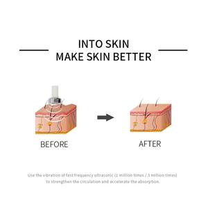 Auro Nuttig 2 In 1 Ultrasonido Huidverstrakking Vlek Wrat Verwijderaar Huid Reiniging Schoonheid Machine - Product Image 6